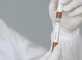 Normal_coronatest_coronavirus_corona